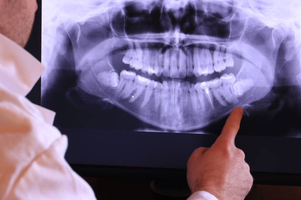 Best Emergency Dental Services for Seniors in Edgemere, MD